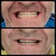 Slider image (10) Dr. Aleksandar Kovacevic - Dental Clinic in Croatia